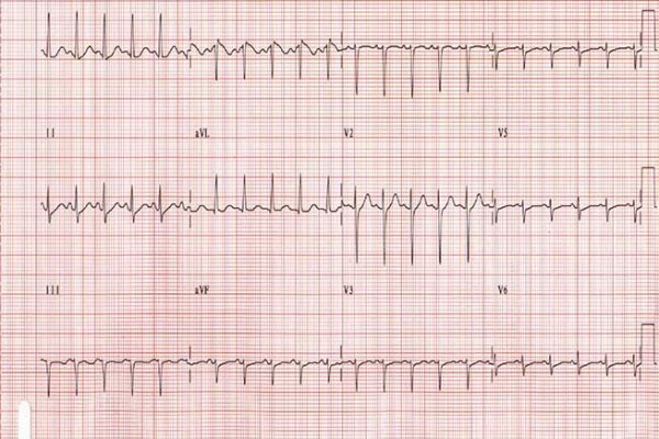 Кракен зеркало маркетплейс